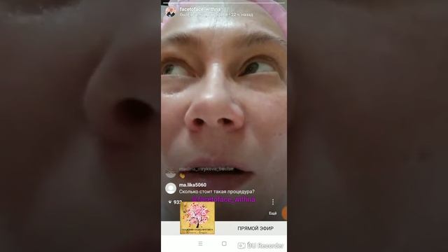 Хиджама на лицо.Подготовительный этап смотреть онлайн