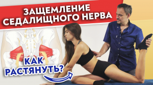 Защемило седалищный нерв — что делать?
Как разблокировать седалищный нерв без боли?
