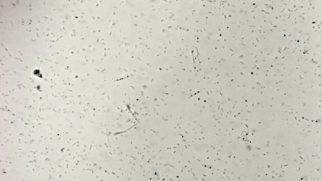 Bacillus subtilis споруляция Din x20 V3MP смотреть онлайн