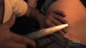 Оводы    человеческий кожный овод лат  Dermatobia hominis