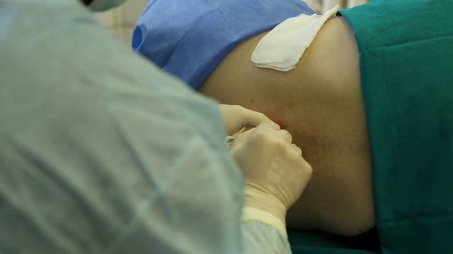 Техника выполнения спинномозговой пункции смотреть онлайн