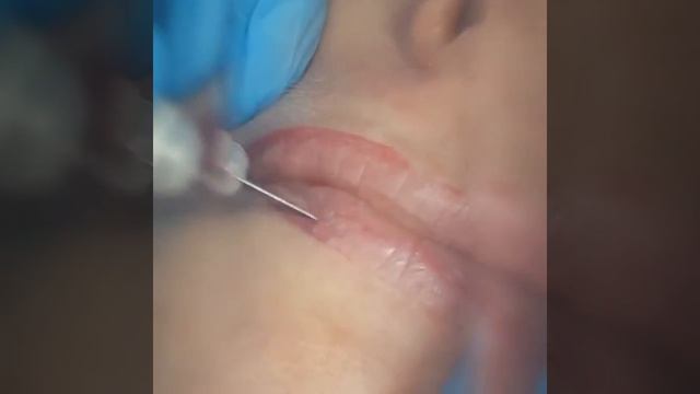 Микроблейдинг Губ смотреть онлайн