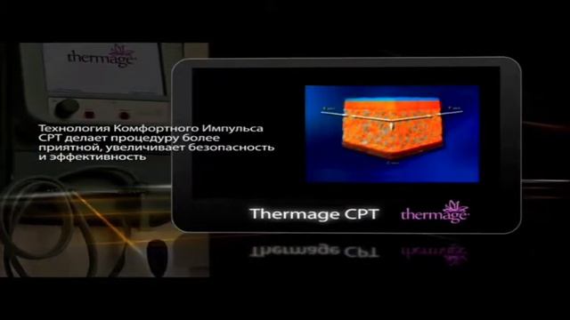 Thermage CPT / Термаж - этапы процедуры и результат