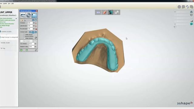 3Shape 2014 "Splint Designer" смотреть онлайн