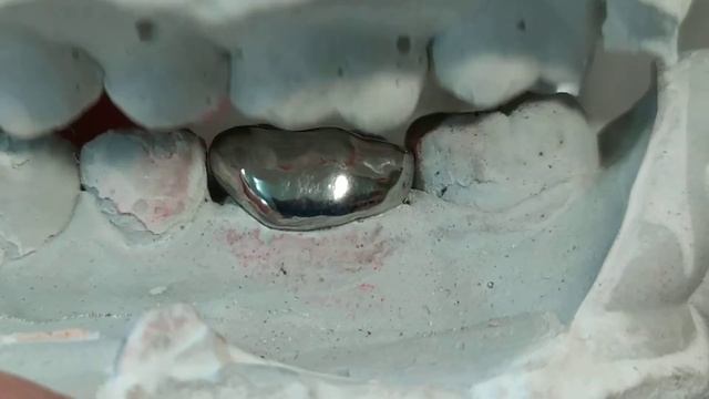 Cad-cam цельнолитая коронка Harz Labs смотреть онлайн