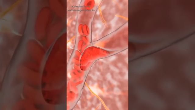 Что такое инсульт? #инсульт #медицина #школа #егэ смотреть онлайн