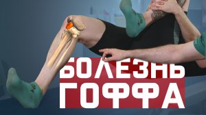 Болезнь Гоффа. Ущемление жирового тела Гоффа.