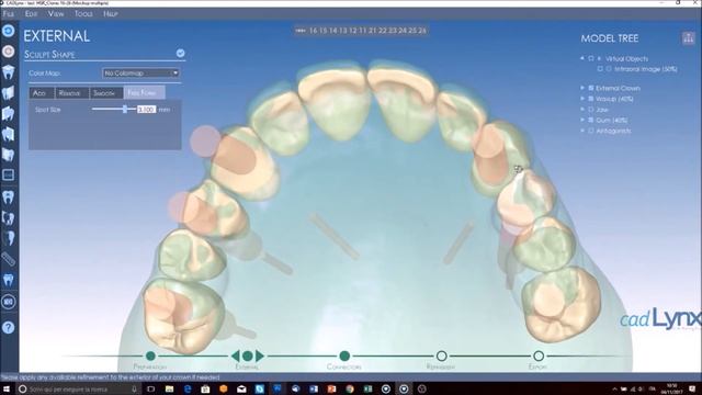 VIP Technique with Smile + CAD Lynx смотреть онлайн