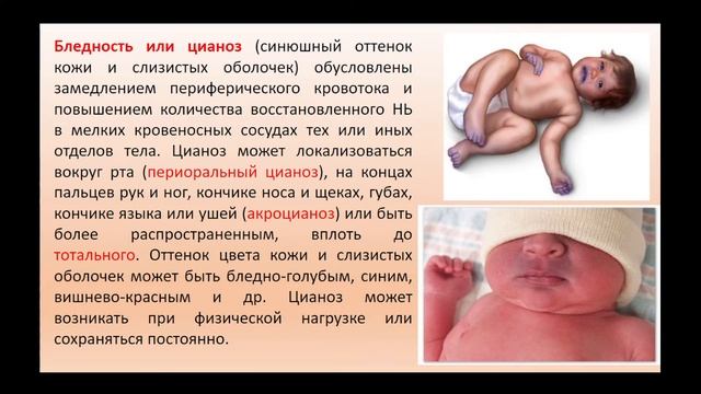 15:40 Анатомо-физиологические особенности сердечно-сосудистой системы у детей смотреть онлайн