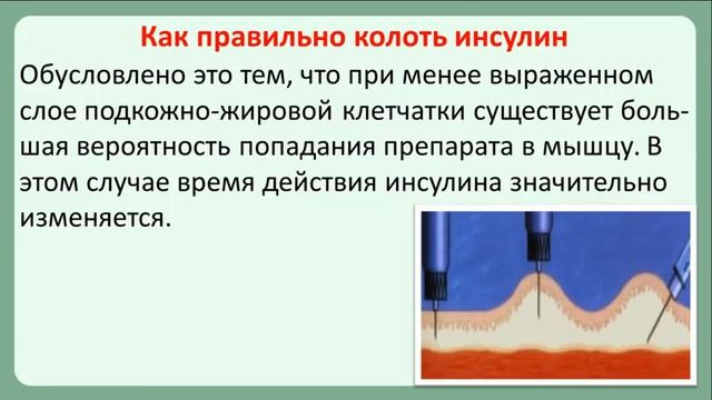 Преимущества и недостатки шприц-ручки для инсулина смотреть онлайн