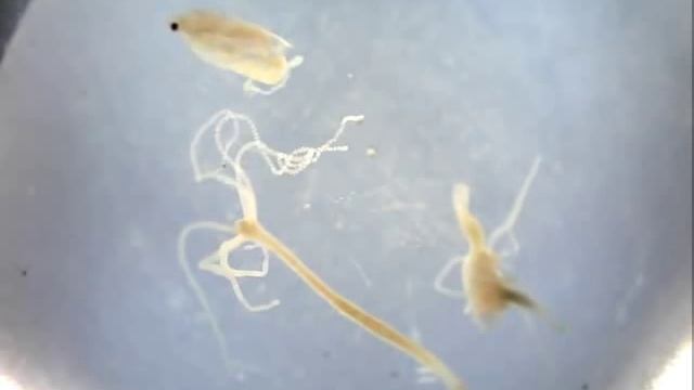 Hydra eats Daphnia 3 смотреть онлайн