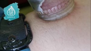 Правка живота, горшок на пупок