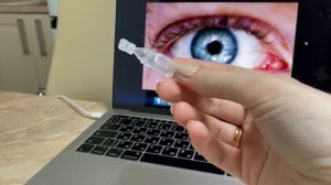 СИНДРОМ СУХОГО ГЛАЗА - КАК ИЗБАВИТЬСЯ ОТ СУХОСТИ ГЛАЗ? ГИЛАН