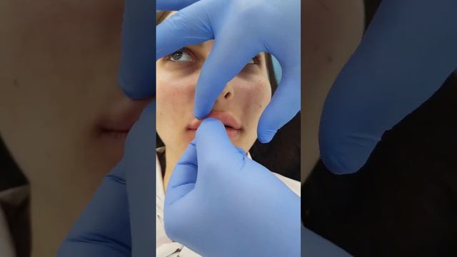 Нужно ли массировать губы после увеличения губ?