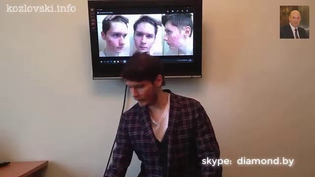 Как избавиться от прыщей. Супер результат! Отзыв молодого человека смотреть онлайн