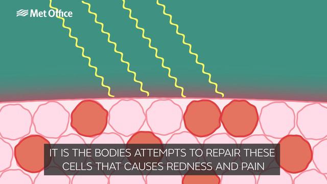 What is UV and how does it affect us? смотреть онлайн