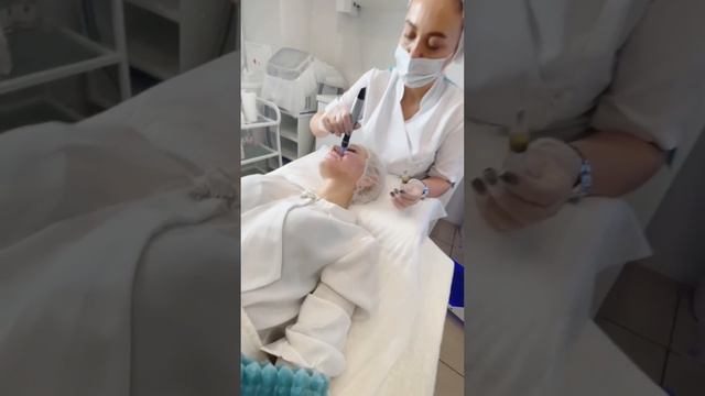 Фракционный пилинг — сочетание фракционной мезотерапии и химического пилинга. Моя любимая процедура!