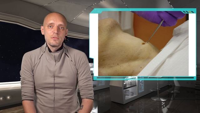 Коникотомия и коникопункция. Часть 2. #ПроСМП смотреть онлайн