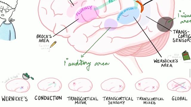 APHASIA : CAUSES , TYPES & APPROACH TO DIAGNOSE