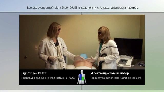 УДАЛЕНИЕ ВОЛОС НА СПИНЕ LightSheer Duet смотреть онлайн