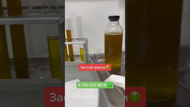 Зондирование желчи @nurtazayeva_moldir смотреть онлайн