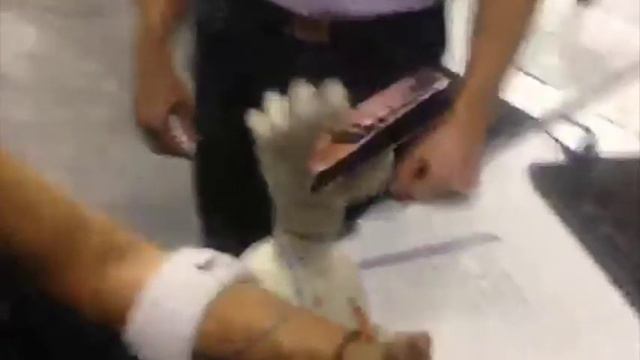 #SMITSPACE бионический протез кисть Michelangelo