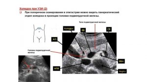 УЗИ. Доктор Иогансен. Выпуск 22. Методика ультразвукового исследования желчевыводящей системы.