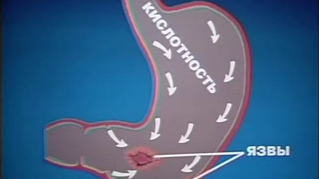 Стоп смокинг #4