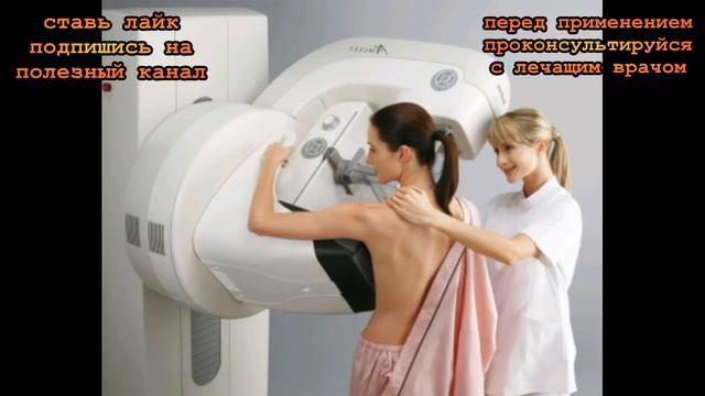 ★ Причины РАКА молочных желез у женщин. Рак груди не пропусти смотреть онлайн