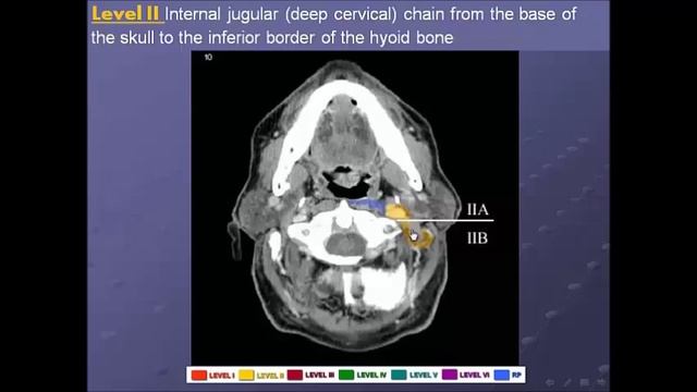 Cervical Lymph Nodes Levels смотреть онлайн