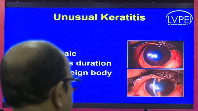 AIOC2020 - GP116 - Microbial Keratitis: Management Pearls Microbial Keratitis ( Ecla Session ) смотреть онлайн
