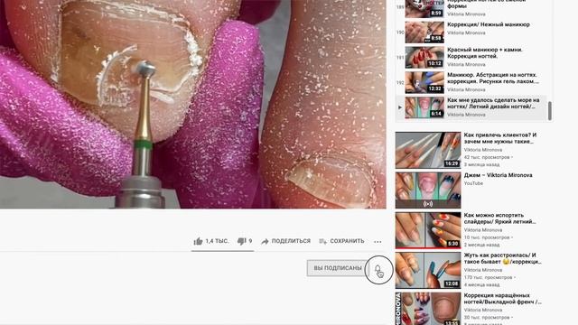 Что же случилось с этими ногтями?. Частичный педикюр. Ушиб пальца. смотреть онлайн