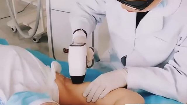 2022 New Model- MBT Omegy Diode Hair Removal Machine