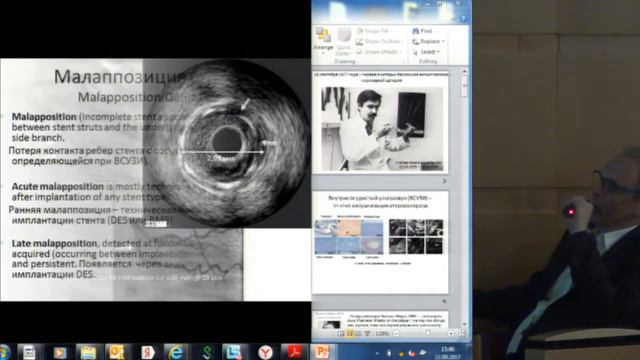 П.А. Болотов, Внутрисосудистый ультразвук и оптико-когерентная томография коронарных артерий .. смотреть онлайн