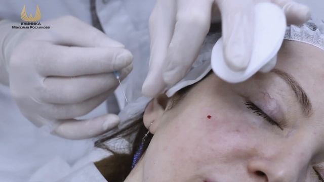 Мезорэдиесс