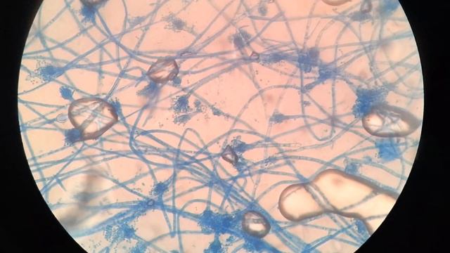 Penicillium spp. смотреть онлайн