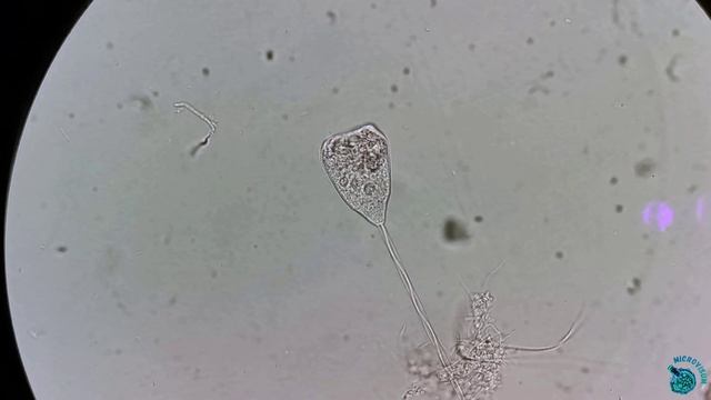 Одинокий танец инфузории Vorticella смотреть онлайн