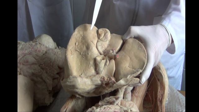 Fetal circulation смотреть онлайн