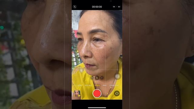 Xóa nhăn , nâng cơ mà không tiêm chích xâm lấn gì như này vi diệu không ạ смотреть онлайн