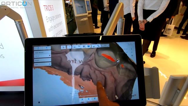 IDS 2019 - Стенд 3Shape: новый Trios 4 интраоральный сканнер смотреть онлайн