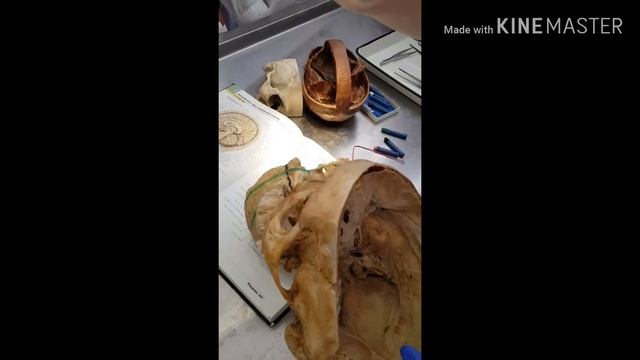 Kronlein Brisov's Scheme смотреть онлайн