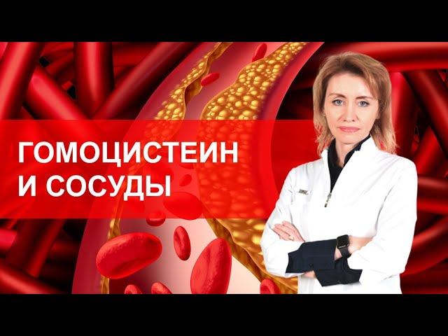 Гомоцистеин и сосуды. Мнение кардиолога. Анна Кореневич смотреть онлайн