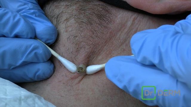 Neck POW! | Dr. Derm смотреть онлайн