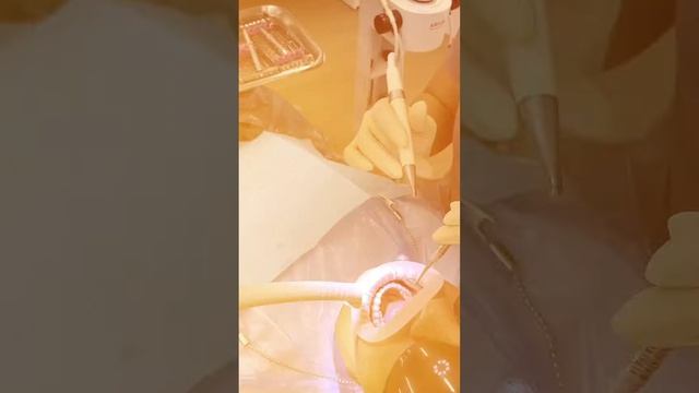 Этапы профессиональной гигиены полости рта AIR FLOW? смотреть онлайн