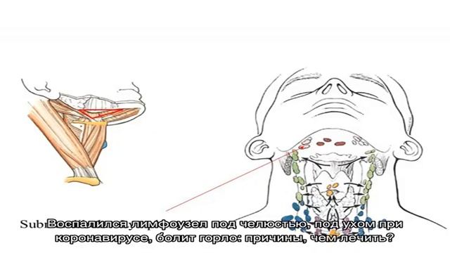 Что делать, если воспалился лимфоузел под челюстью: к какому врачу обращаться, чем лечить? Подчелю. смотреть онлайн