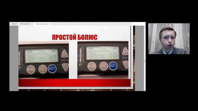 Используем различные виды болюсов на инсулиновой помпе смотреть онлайн