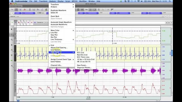 AcqKnowledge Grid Functionality Tutorial смотреть онлайн