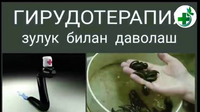 Кандай килиб конни суюлтириш мумкин? смотреть онлайн