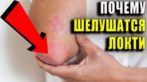 Почему шелушатся локти