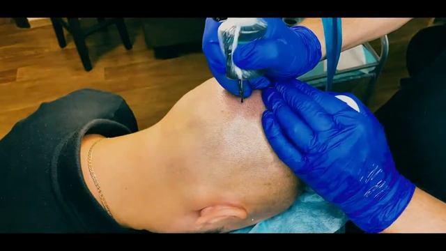Ukraine Trichopigmentation / SMP SavaturTattoo studio смотреть онлайн